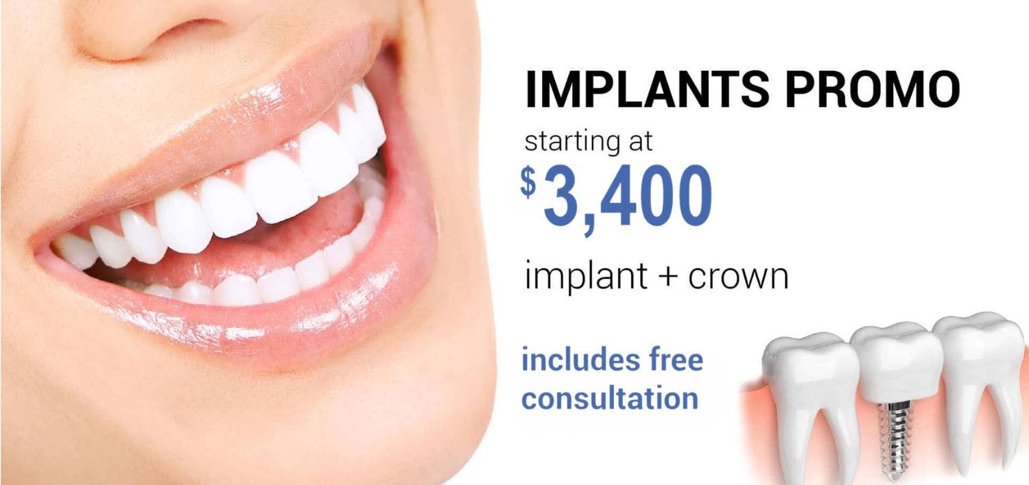 Implant Promo - Includes Free Consultation Implant Promo - Includes Free Consultation