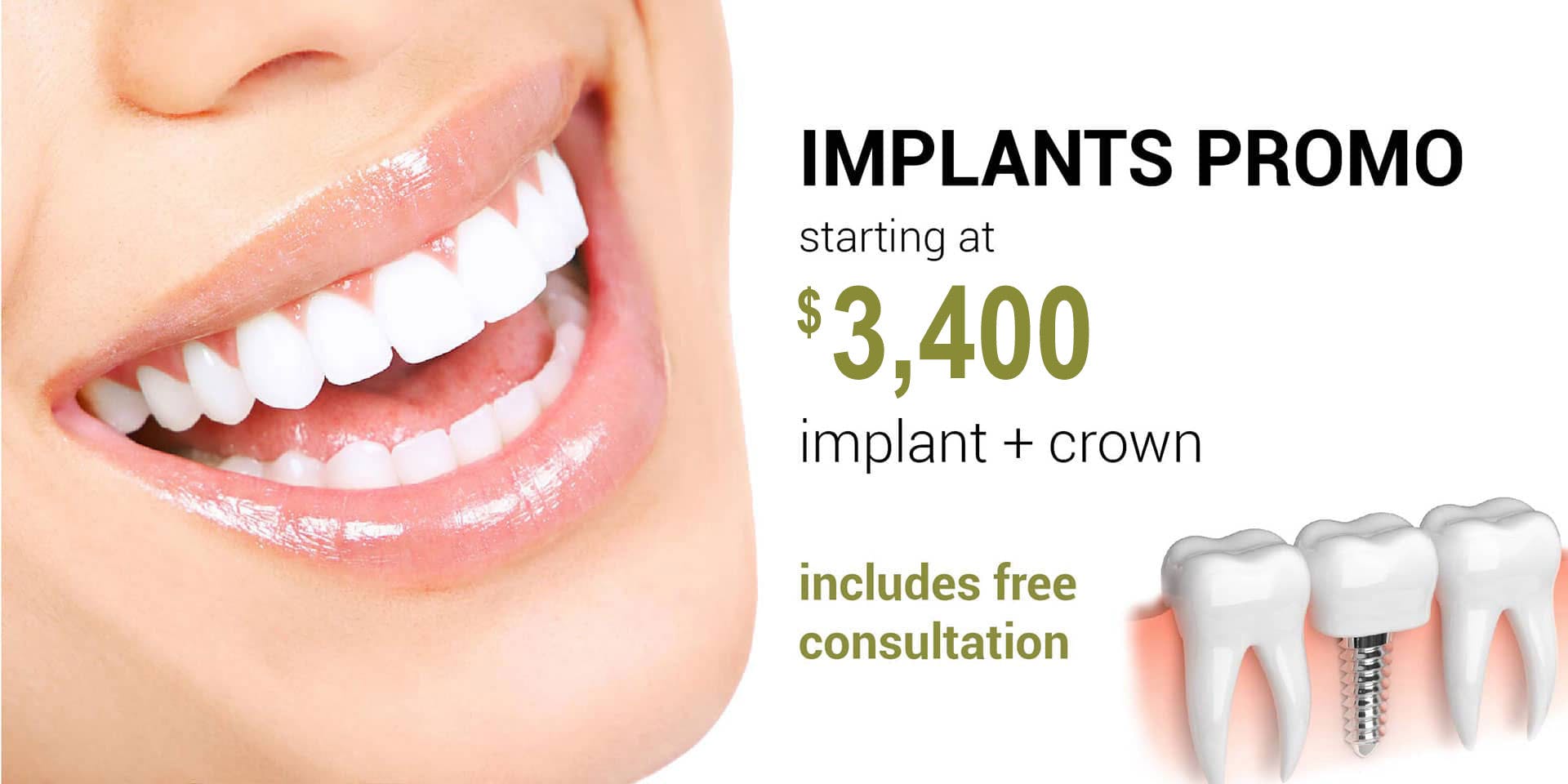 Dental Implants - Denali Dental - Dentist Milton