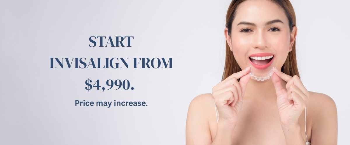 Invisalign Promo - Includes Free Consultation Implant Promo - Includes Free Consultation